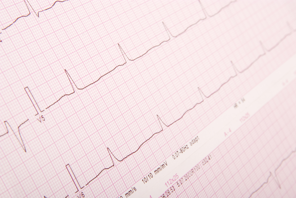 Бета-блокаторы неэффективны при многих заболеваниях сердца