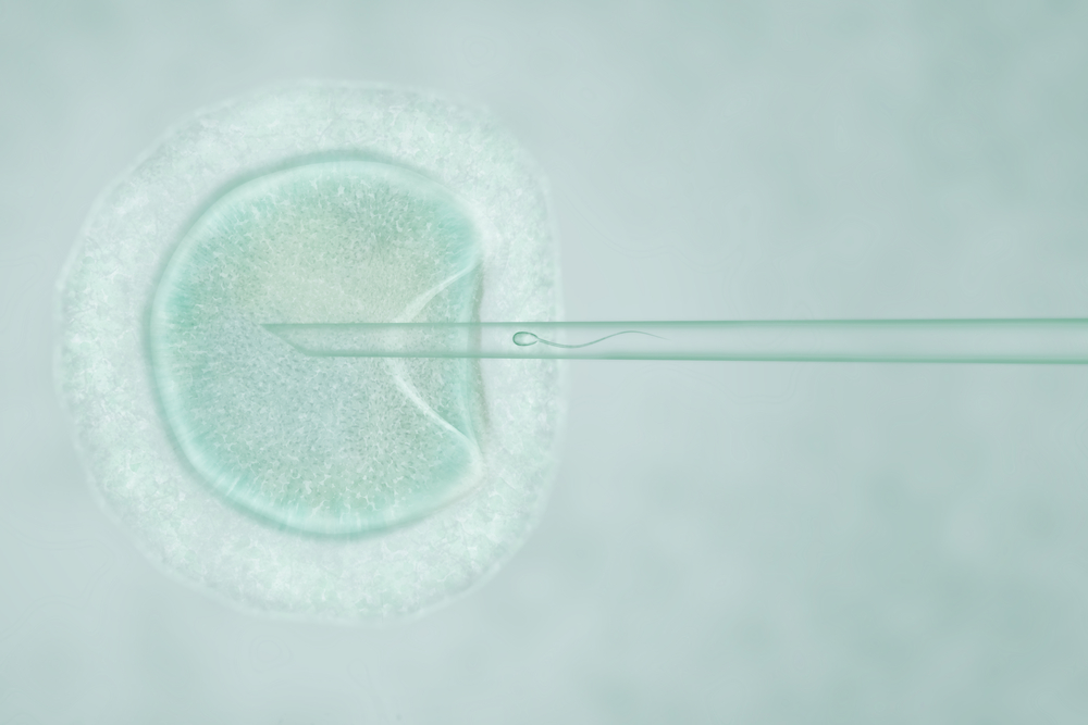 Вспомогательные репродуктивные технологии: что такое ИКСИ?