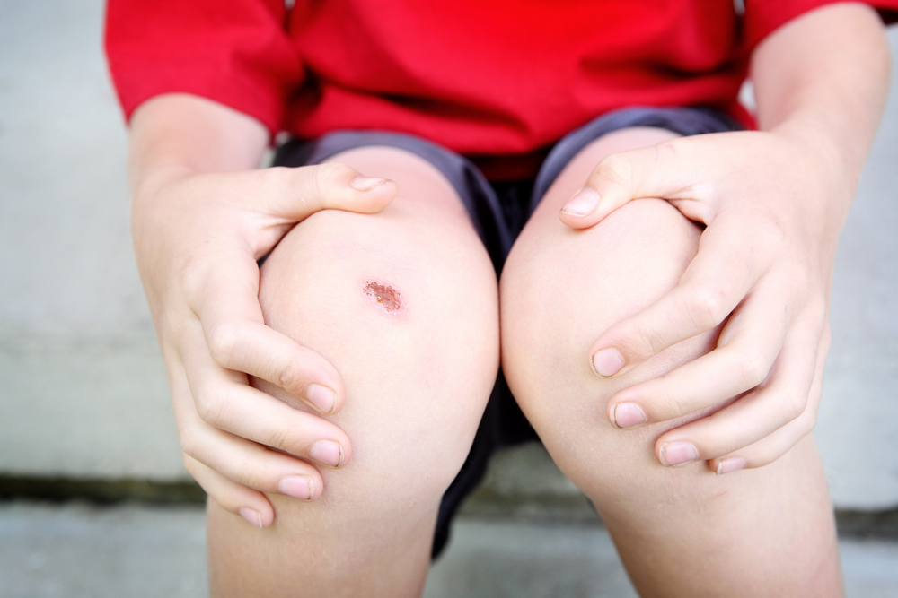 Детский травматизм: лечим ссадины, порезы, царапины  