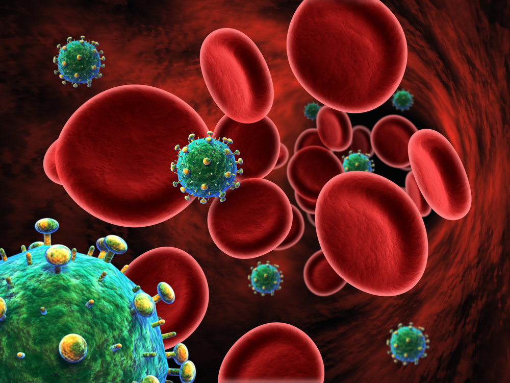 Клетки ВИЧ в крови, СПИД