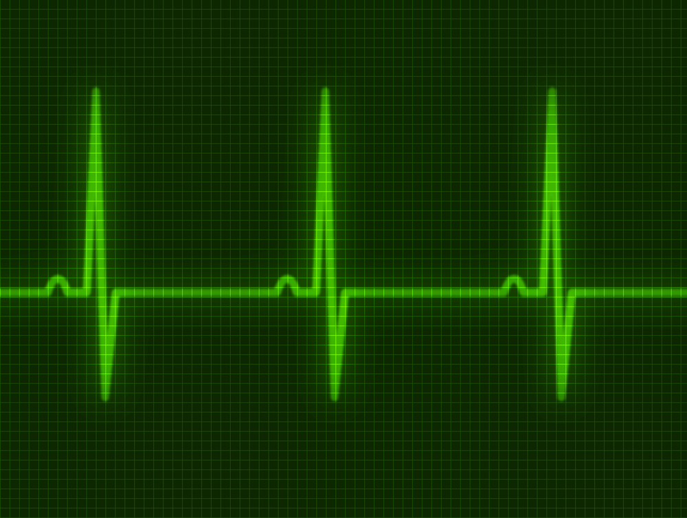 Разработан кардиостимулятор, работающий от биения сердца