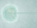 Вспомогательные репродуктивные технологии: что такое ИКСИ?